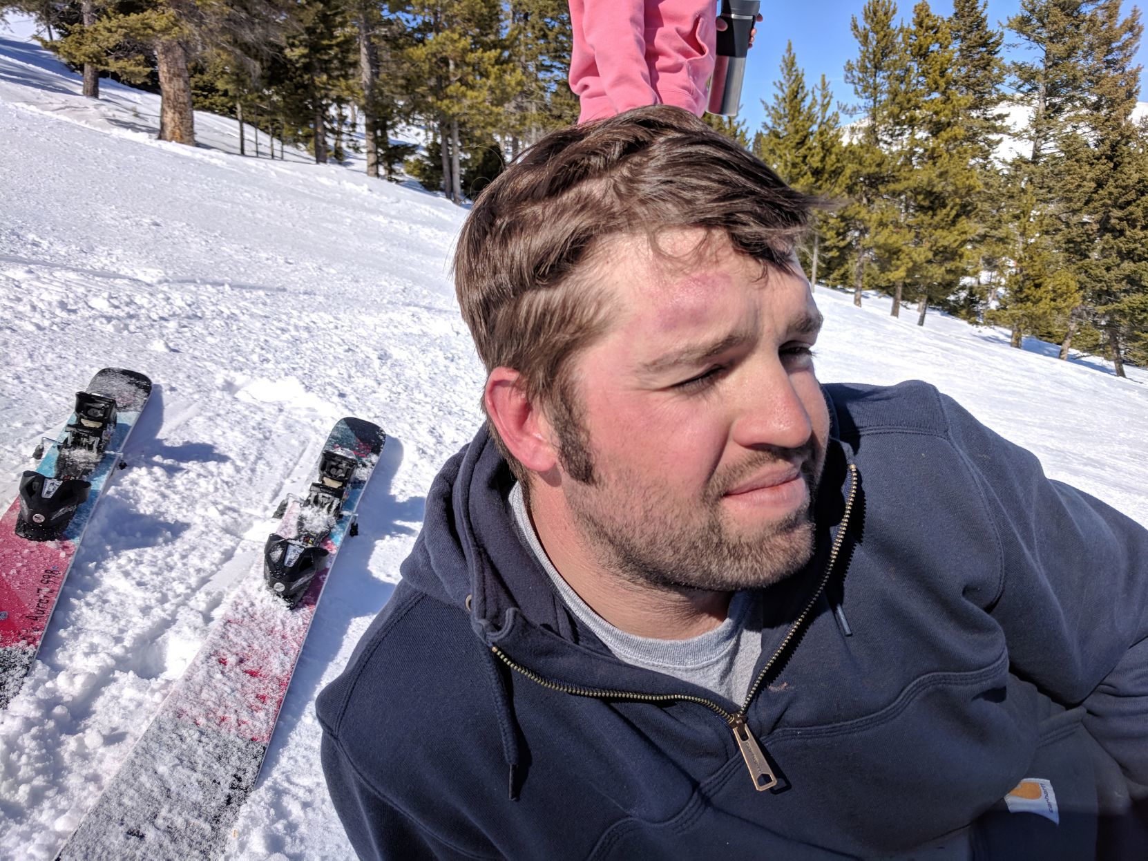 Aaron Griffen's got a shiner